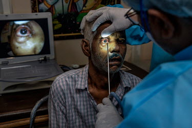ENT specialist, Dr. Brijpal Singh Tyagi, checks a patient who recently recovered from COVID-19 before performing a surgery to remove black fungus (Mucormycosis).