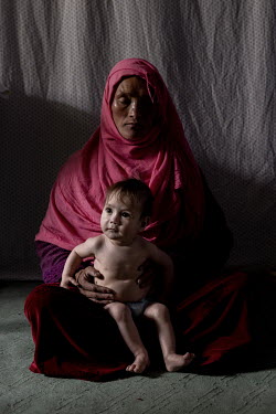 Jamilla (30) with her one year old son Ibrahim who is one of her six children. They are being seen by a health worker in a small clinic managed by UNICEF. Children from the village of Alibeg and surro...