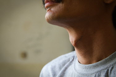 Nasser (29), a newspaper photographer from Baghdad in Iraq. Scars are visible on his throat and chin from what he claims was a violent attack perpetrated against him and his boyfriend. The attack kill...