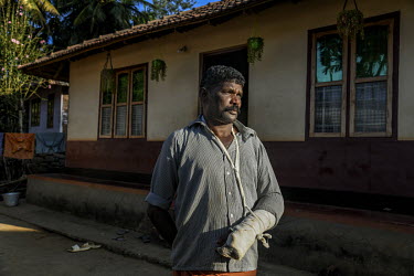 Vijayn TS, forest watcher in Wayanad reserve stands with a bandaged arm and hand outside of his home. He was injured during an elephant attack while on duty.