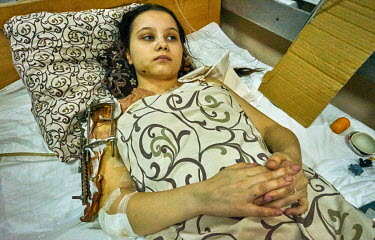Masha Feschenko (15) was badly injured near her home in the city of Polohy, Zaprozhskaya oblast which has been under attack since 2 March 2022. Masha said on 13 March 2022 it was a beautiful day, quie...