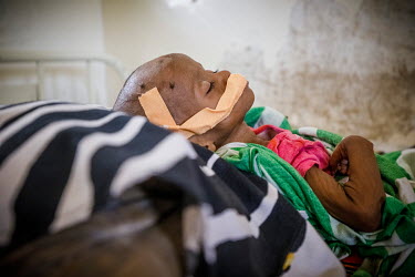 Magda Abdullahi Mohammed, watched over by her great-grandmother (not pictured) in Burao hospital where she has been fighting for her life after being unconscious for four days. She has been in the hos...