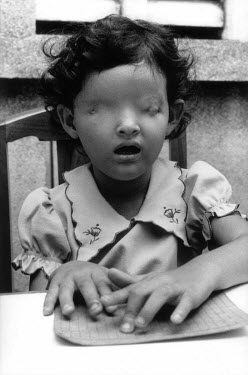 Phuong, who was born without eyes, learns to read braille. it is presumed her mother was poisoned by Dioxin (agent orange) left in the ecosystem after the Vietnam war.