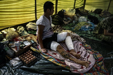 Mon Gyi, a KNLA soldier who was shot in his lower left leg during a firefight with the Myanmar Army and was then lost in the jungle for two days, sits in a People's Defence Force (PDF) medical tent in...