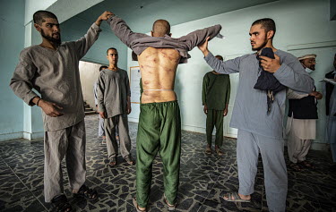 Cosh marks on the back of a patient at the Ibn Sina drug addiction hospital, where he claims he recieved the beating that left the welts.