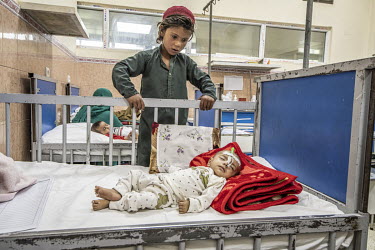 A severely malnourished child lies on a bed at the Indira Ghandi Children's Hospital.
