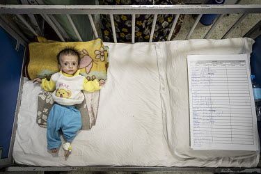 Severely malnourished Rasool Jan lies on a bed next to his medical records at the Indira Ghandi Children's Hospital.