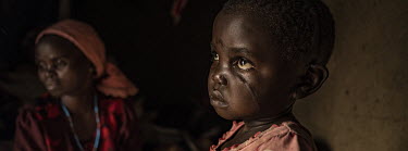 Rachel Ngabusi (5), with her aunt Gave Claudine, at the Kigonze IDP Camp. Rachel's face was scarred when she was attacked with a machete when aged two.  There are at least 5.5 million internally displ...