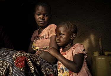 Rachel Ngabusi (5) and her sister Maria Gracia (15) at the Kigonze IDP Camp. Rachel's face was scarred when she was attacked with a machete when aged two, Maria Gracia lost her hand in the same attack...