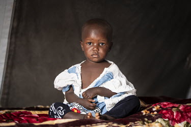 Sandrine (22 months) in the UNICEF creche at the Ebola Treatment Centre in Butembo. Sandrine's mother is seriously unwell with Ebola although Sandrine has not tested positive for the disease.  An Ebol...