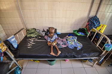 Rasmata Cisse (5), who is being treated for malnourishment in the Kaya Regional Hospital's nutrition unit. The hospital is operating at over 100% capacity, in many cases there are three patients per b...