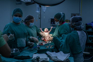 A baby boy is being delivered by cesarian section in San Juan de Dios public hospital in San Miguel. He is the second child born to Erika Carolina Rivera (25) who came to the hospital two days before...