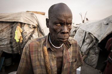 An elderly man with cataracts in both eyes at a displaced persons camp Leer town.  Since the end of 2013, conflict has cost almost 400,000 lives and left six million people, of a population of 11 mill...