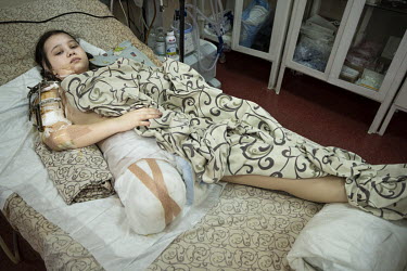 Masha Feschenko (15), from Mauriupol, lies in a bed at Zaporizhzhia Regional Clinical Children's Hospital where she has had her leg amputated.
