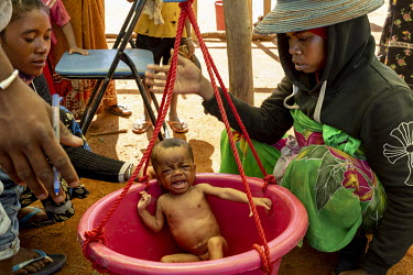 A child is given a health check during a visit by a mobile team from ACF (Action Contre la Faim), who come each week to check for malnourished children and to distribute food aid suppliments.