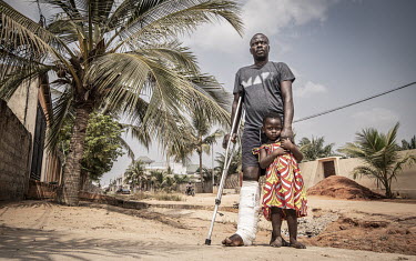 Mechanic Komi Sogbossi (43) with daughter Divine Light (3). Following a motorcycle crash he was left with a shattered tibia. Surgery would cost him two year's salary, a price he can't pay. He has turn...