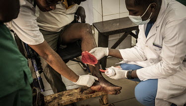 A patient is treated for a deep wound to his ankle in the Sylvanus Olympio hospital following a motorcycle accident. At least 20 patients arrive each day as a result of motorcycle accidents.As motorcy...