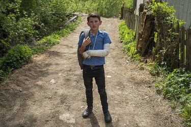 A young boy with his arm in a cast.High in the mountains above Poienile de sub Munte, said to be Romania's largest village, is an unnamed community of smallholders that some callDardila's Hill, after...