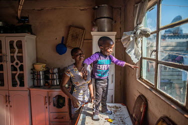 Four-year-old Bailley Chasweka, who was born with bilateral clubfoot, stands on the kitchen table in his home with mother, Sandra. Initially, she was concerned he would never be able to walk, but afte...