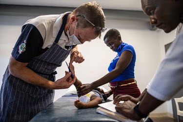 Dr Ryan Bathurst, Director of the Zimbabwe Sustainable Clubfoot Program, uses a pen to assess the straightness of a patient's feet at a clubfoot clinic.Clubfoot, a condition that causes one or both fe...