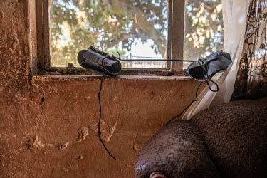 A corrective foot brace belnging to four year old Bailley Chasweka lies on a windowsill at his home. Bailley was born with bilateral clubfoot but is now nearing the end of the treatment process.Clubfo...