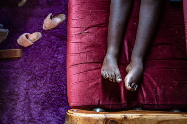 14-year-old Patience Kanyangarara, who was born with severe bilateral clubfoot, sits on a sofa at her home. Due to resistance from her father, who did not believe a hospital could help her, Patience o...